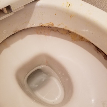 トイレ尿石